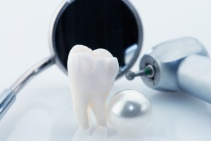 implantologia dentale non fa male