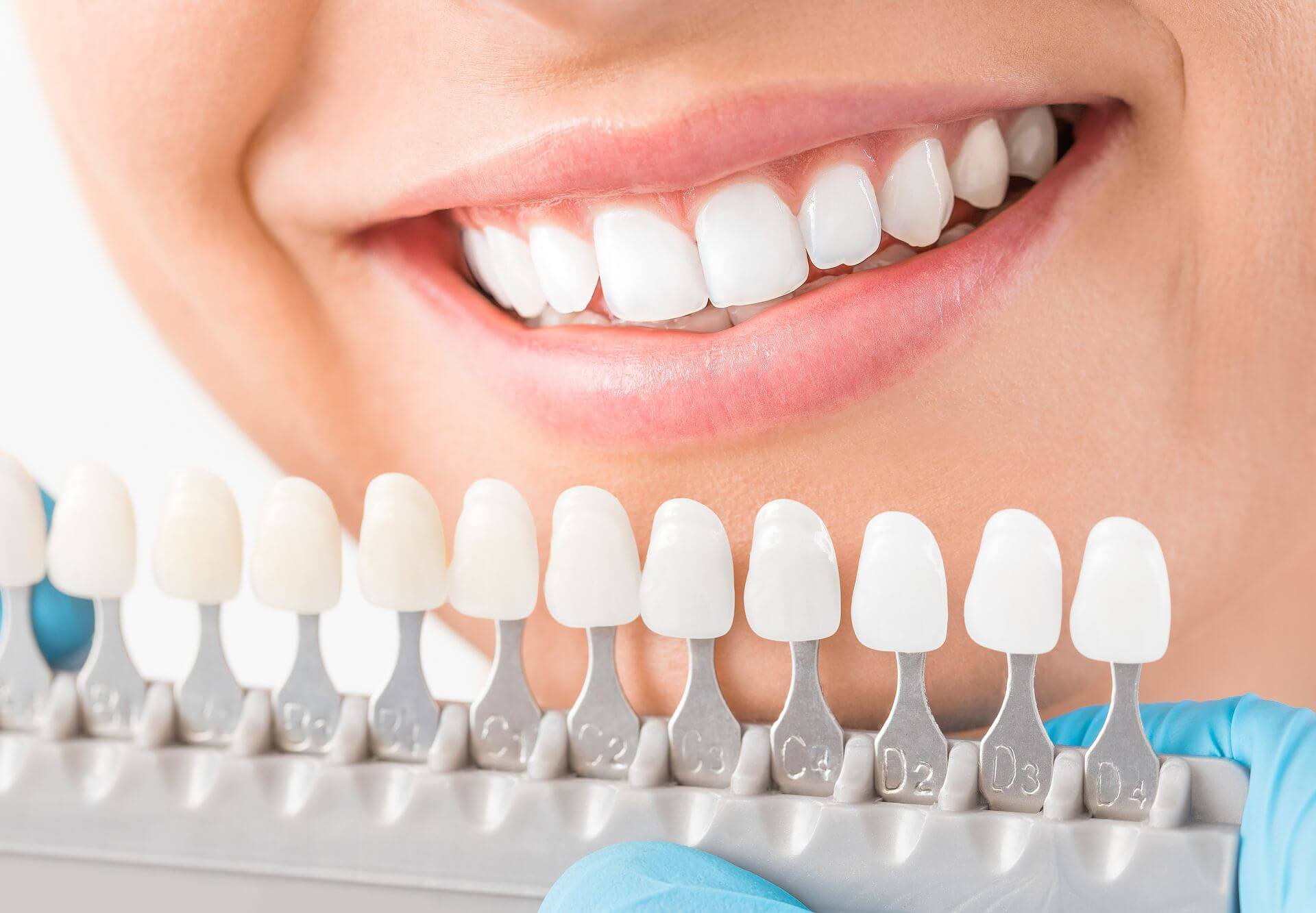 La protesi cosmetica dentale La protesi cosmetica dentale