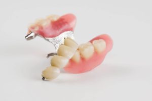 Protesi mobili dentali combinate