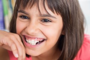 apparecchi per denti bambini