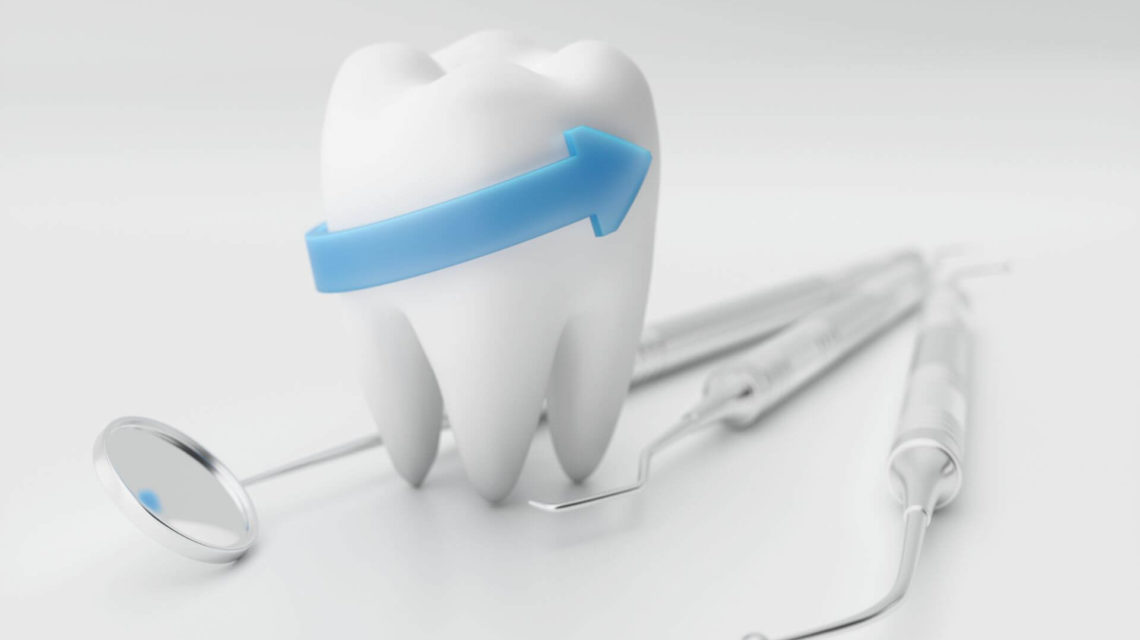 chirurgia orale estrazione denti