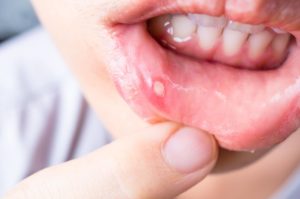 riconoscere una patologia orale