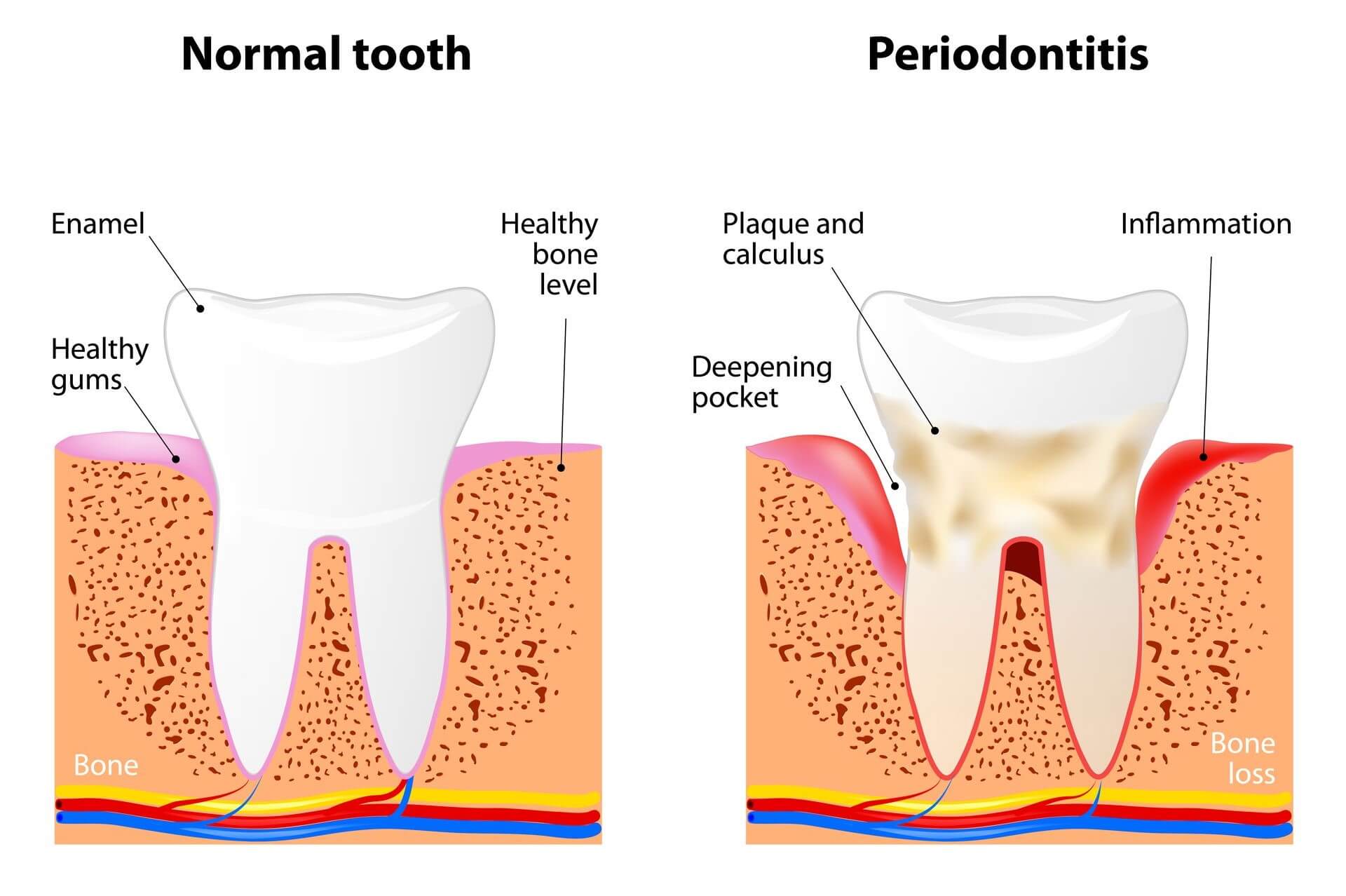 Malattie dei denti e parodontologia