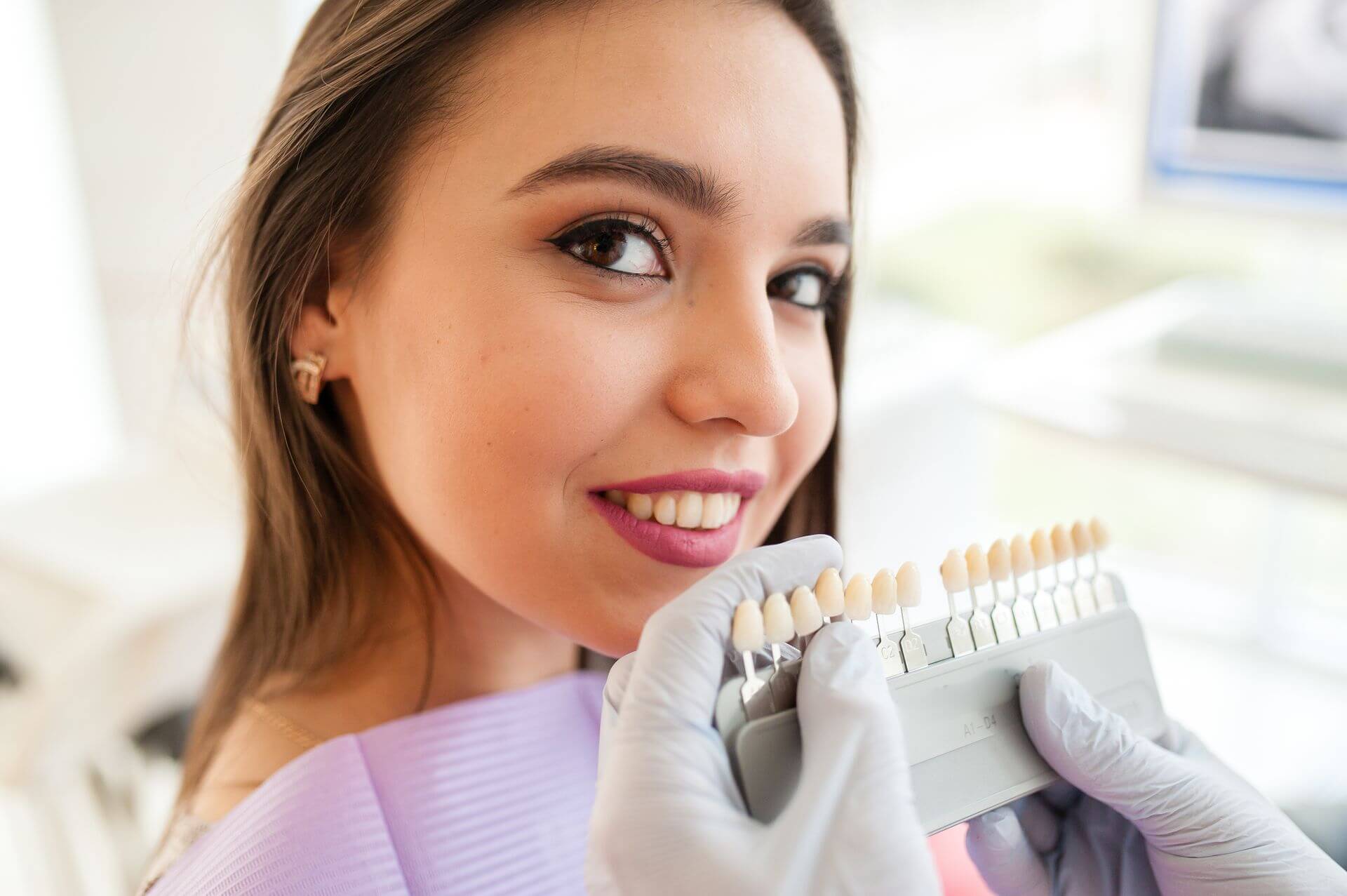 faccette dentali
