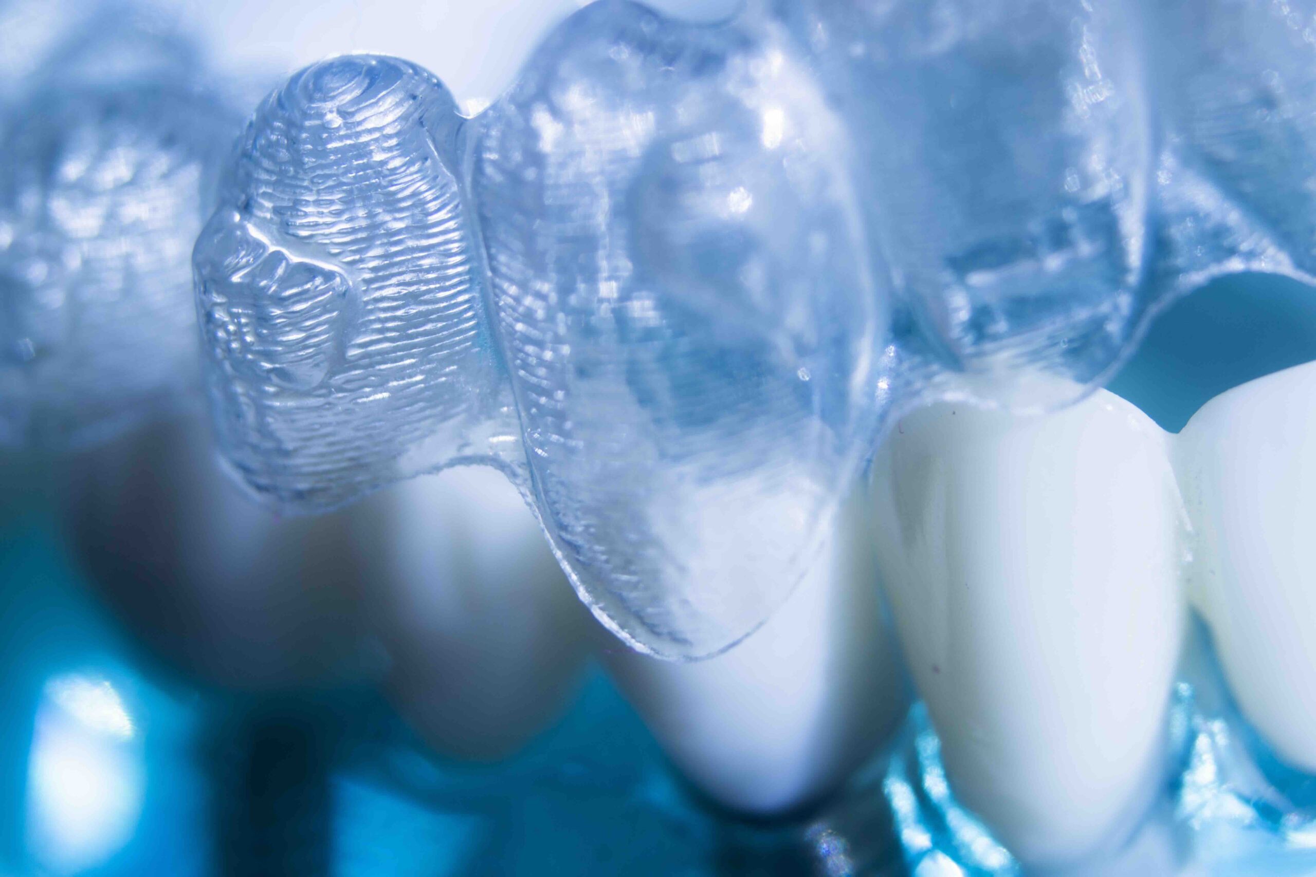 Glossario Odontoiatria Estetica