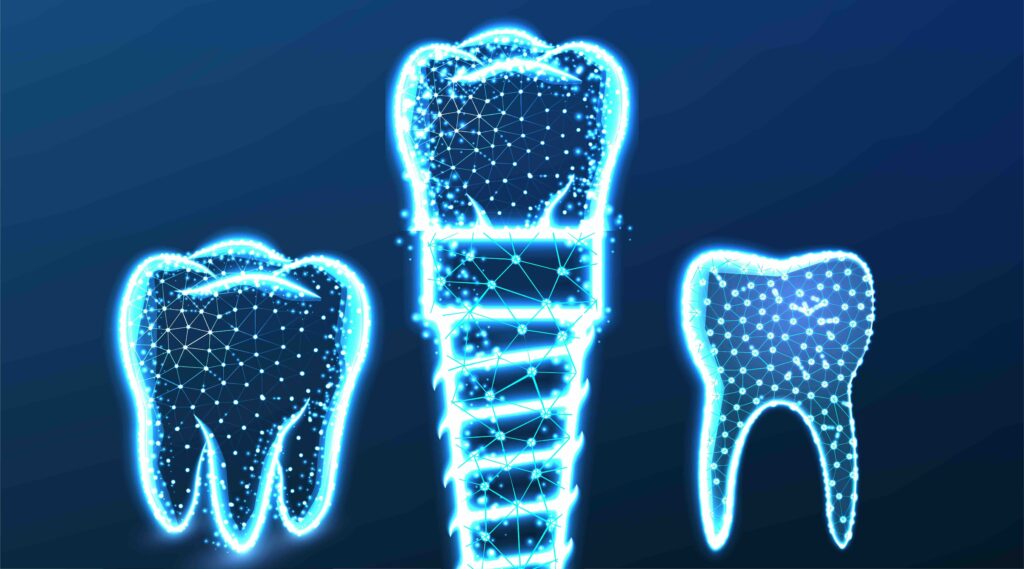 Glossario implantologia dentale